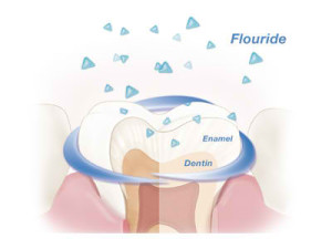 Fluoride - The Best Dental Health Booster