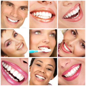 Smiling young people with healthy white teeth